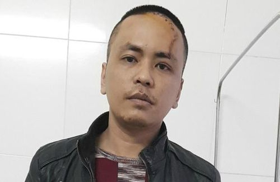 Đánh bố đẻ, chém công an trọng thương - 1 Đánh bố đẻ, chém công an trọng thương - 1