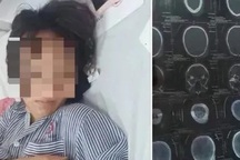 Quảng Ninh: Xác minh vụ nữ sinh bị đánh hội đồng đến tụ máu đầu