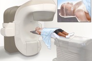 Phương pháp xạ trị trong điều trị ung thư vòm họng