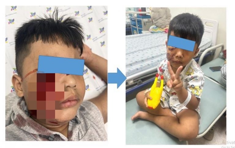 TPHCM: Khối nghỉ hè liên tục đi cấp cứu vì bị động vật tấn công - 1