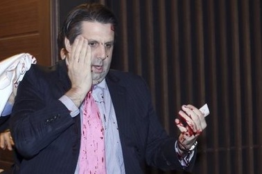 Tổng thống Hàn Quốc: Vụ tấn công Đại sứ Mỹ là không thể dung thứ