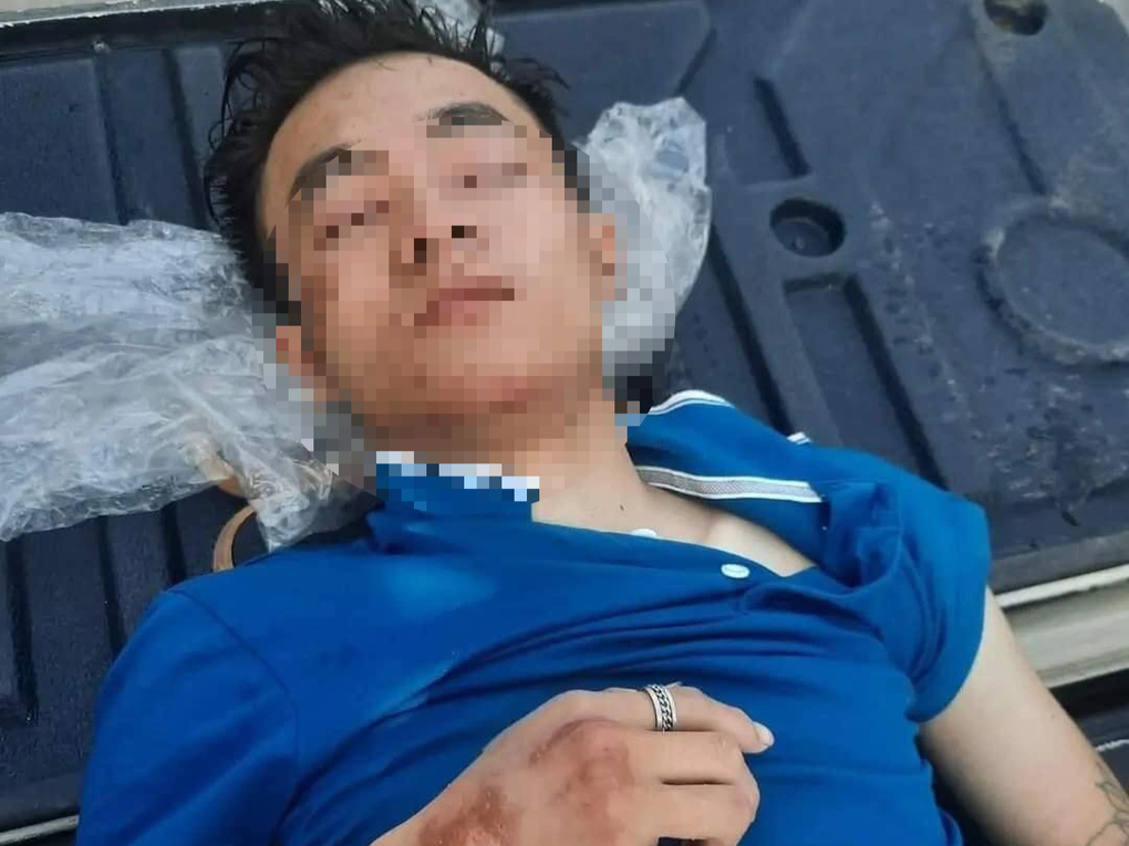 Thanh niên câm điếc nghi bị đánh đập đến bất tỉnh ở nghĩa địa - 1 Thanh niên câm điếc nghi bị đánh đập đến bất tỉnh ở nghĩa địa - 1