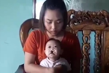 Xót xa bé 4 tháng tuổi bị tim bẩm sinh, hở hàm ếch