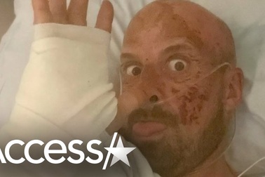 "Sao" America's Got Talent lộ diện lần đầu sau tai nạn