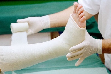 8 cách tự nhiên giúp xương nhanh liền