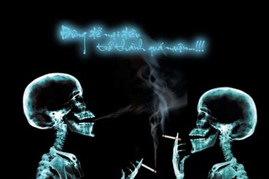 Nguy cơ ung thư tuỷ xương vì hút thuốc