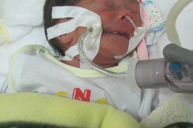 Kỳ tích của bé sơ sinh nặng... 6 lạng