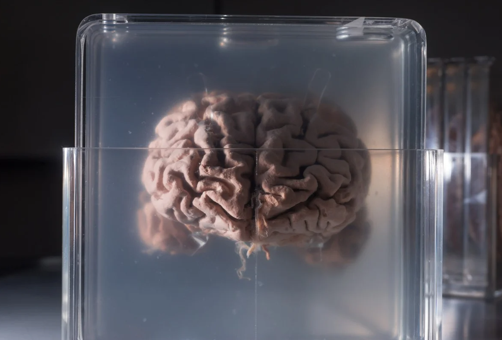 Bộ não thiên tài của Einstein đứng trước cơ hội được giải mã sau 70 năm - 2 Bộ não thiên tài của Einstein đứng trước cơ hội được giải mã sau 70 năm - 2