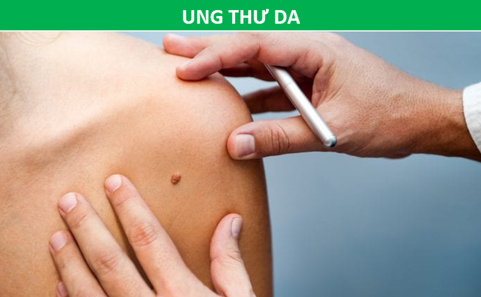 Những phương pháp tầm soát ung thư giúp bạn chủ động trước bệnh tật - 9 Những phương pháp tầm soát ung thư giúp bạn chủ động trước bệnh tật - 9