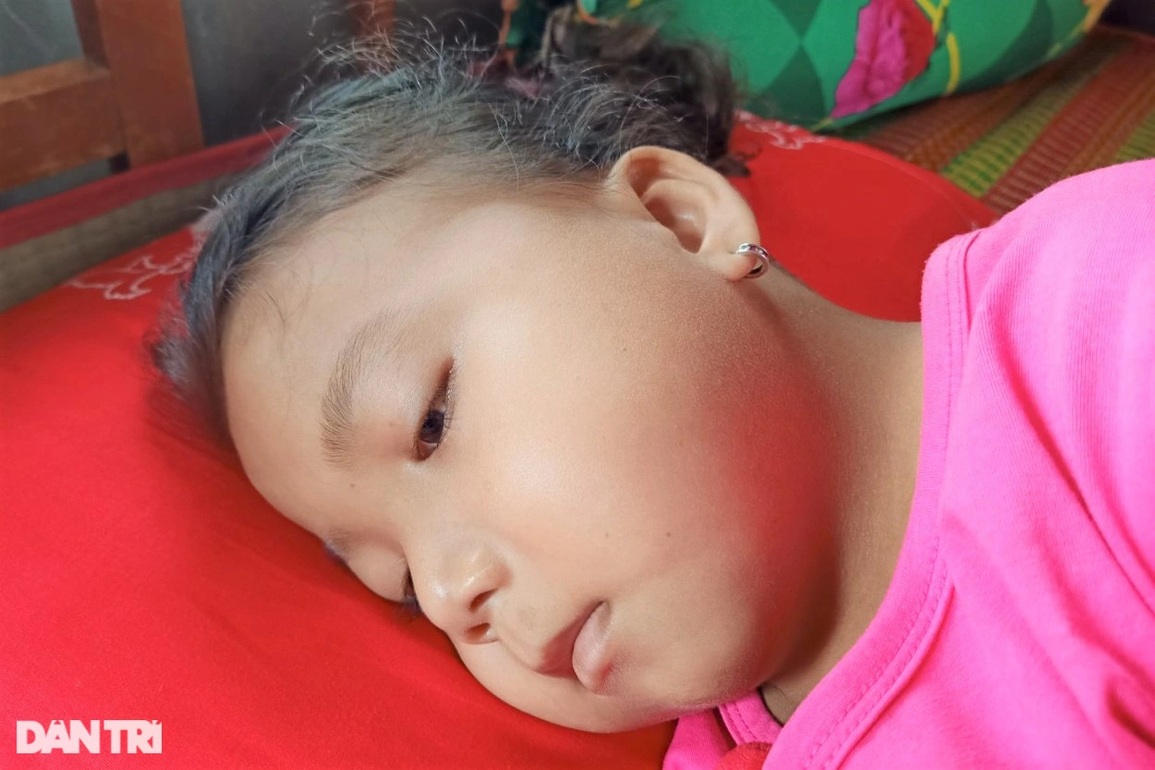 Suy thận giai đoạn cuối, bé gái chờ chết vì không có tiền điều trị - 3 Suy thận giai đoạn cuối, bé gái chờ chết vì không có tiền điều trị - 3