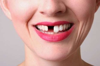 Công nghệ khiến răng tự mọc lại sau khi rụng: Sẽ không còn ai phải trồng răng!