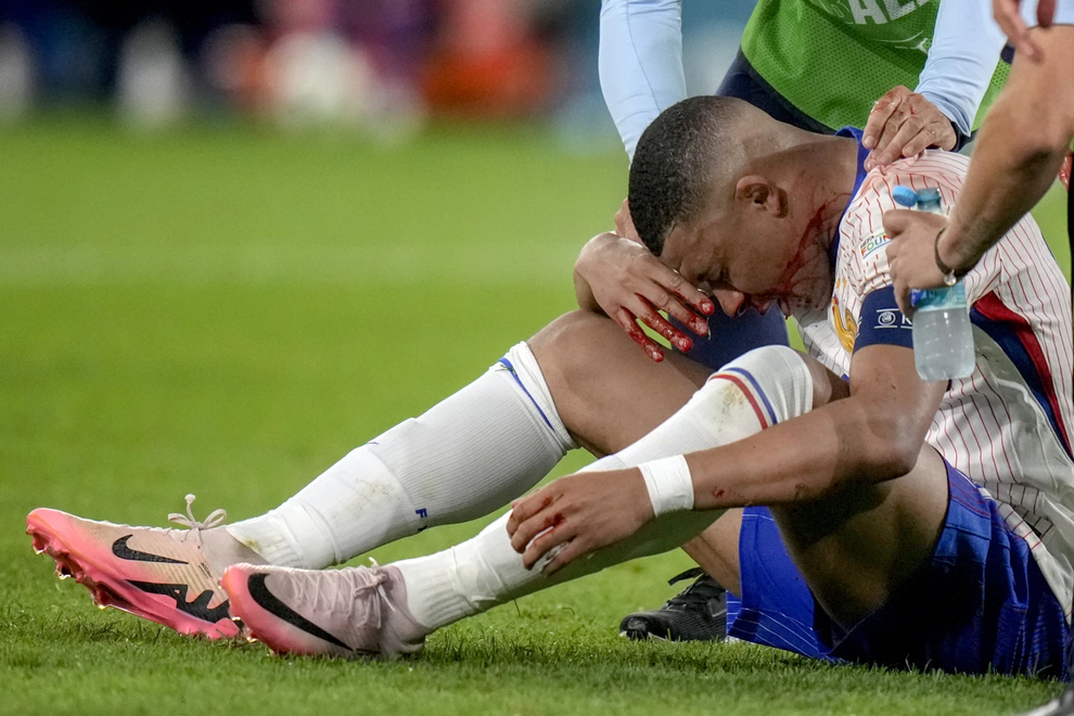 HLV Deschamps lên tiếng về tình trạng của Kylian Mbappe - 1 HLV Deschamps lên tiếng về tình trạng của Kylian Mbappe - 1