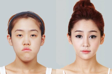 Vì sao Hàn Quốc trở thành "kinh đô phẫu thuật thẩm mỹ" của thế giới?