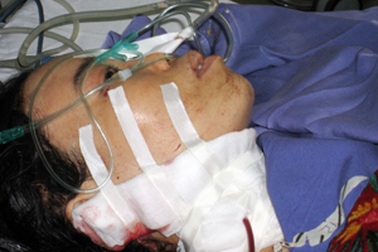 Khách thuê phòng sát hại nữ nhân viên nhà nghỉ