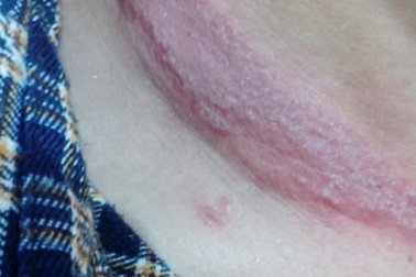 Kiến ba khoang tấn công ký túc xá, sinh viên hoang mang