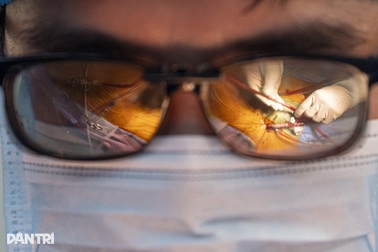 Hồi hộp xem bác sĩ đeo kính 3D "xe chỉ, luồn kim" cứu trái tim lỗi nhịp