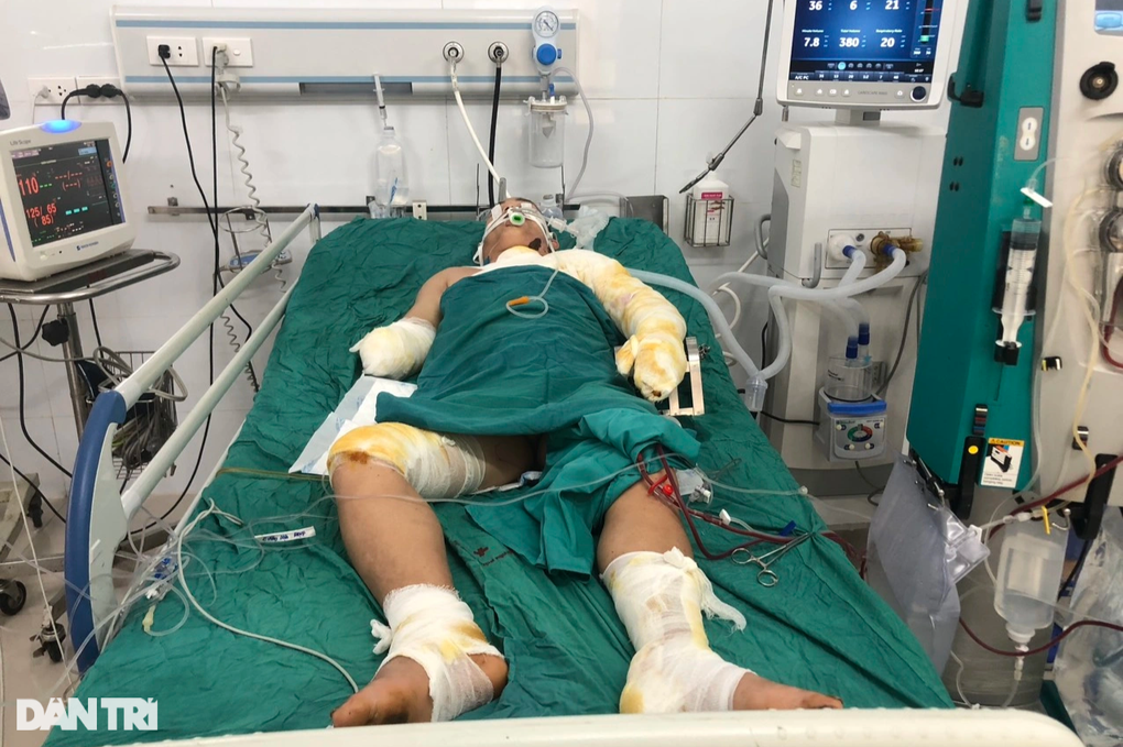Vợ nghèo khóc trước phòng hồi sức, xin bạn đọc cứu chồng nguy kịch vì bỏng - 2 Vợ nghèo khóc trước phòng hồi sức, xin bạn đọc cứu chồng nguy kịch vì bỏng - 2