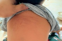 Vụ cô giáo bị tố bạo hành trẻ 15 tháng tuổi: Tiếp tục đình chỉ 2 giáo viên