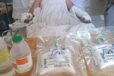 Thả diều bị điện giật, cháy xém hạ bộ