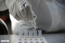 Biến thể phụ EG.5 của Omicron - nguy cơ làn sóng mới trên toàn cầu