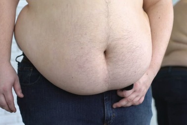 Công viên nước gây tranh cãi vì ưu đãi sâu cho khách khoe “bụng phệ”