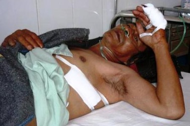 Con rể “hờ” đâm chết mẹ vợ vì ngăn cản đánh vợ