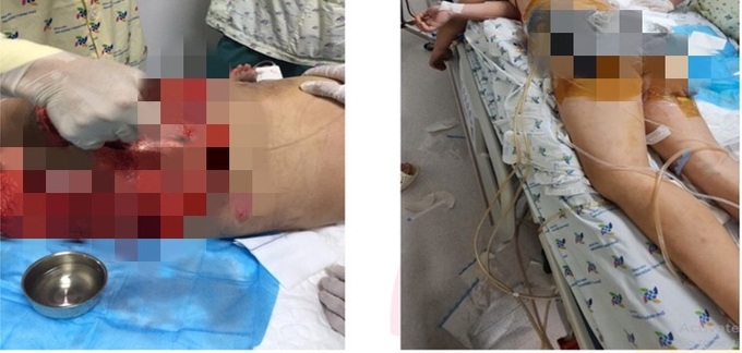 Bé 8 tuổi hồi phục ngoạn mục sau tai nạn giao thông - Ảnh 2. Bé 8 tuổi hồi phục ngoạn mục sau tai nạn giao thông - Ảnh 2.