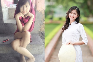 Ngỡ ngàng bộ ảnh “dậy thì thành công” của cô gái khoe tài "khoèo chân" một thời