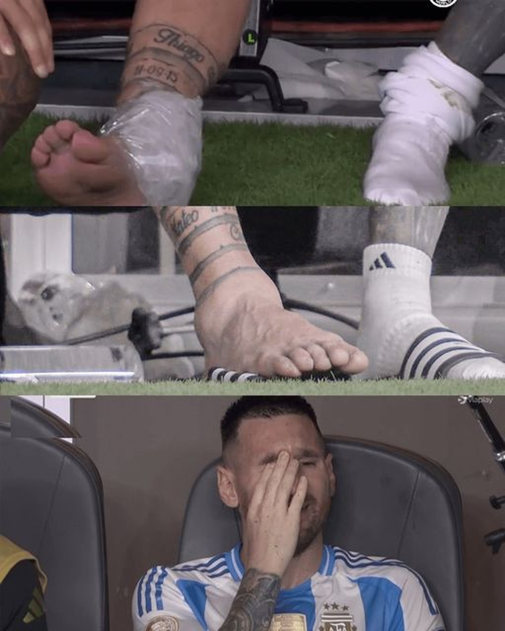 Messi's leg deformed due to injury in Copa America final - 1