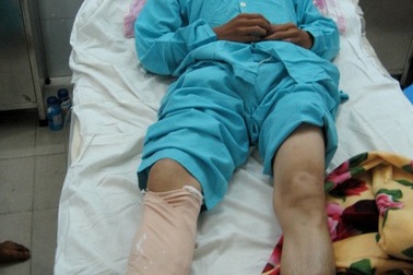 Chủ quán bị chém vì “tội” đông khách