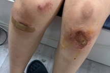 Vụ thiếu nữ 17 tuổi bị đánh hội đồng ở Hà Nội: Khởi tố 2 bị can