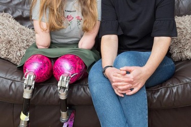 Gặp cô gái "không tay chân" trở thành blogger trang điểm đình đám trên Youtube