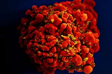 Ca nhiễm virus HIV được chữa khỏi thứ 3 trên thế giới