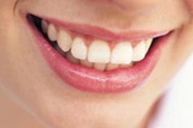 Hà Nội: Đổ xô đi tẩy trắng răng