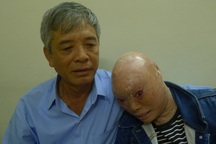 "Mắt con không nhìn thấy gì nữa rồi, bố ơi !"