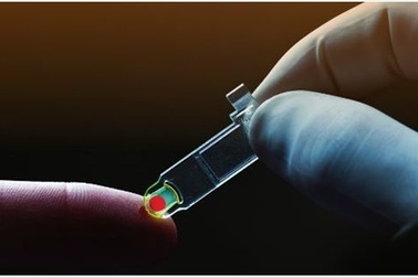 Vì sao chỉ số HbA1c cao trong khi đường máu ổn định?