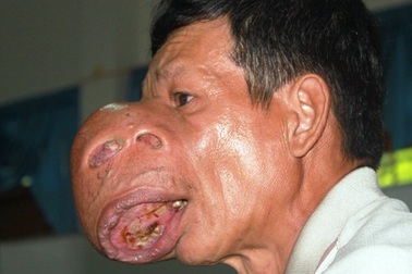 Trả lại nụ cười trẻ thơ