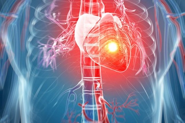 Nguy hiểm như cơn đau tim thầm lặng