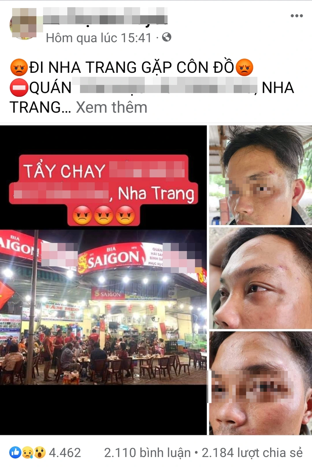 Du khách tố bị 8, 9 nhân viên quán hải sản ở Nha Trang hành hung - 1 Du khách tố bị 8, 9 nhân viên quán hải sản ở Nha Trang hành hung - 1