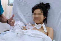 Bác sĩ "cân não" hóa trị cho cô gái trẻ đang hôn mê nguy kịch