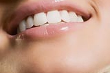 Sâu răng - Âm thầm mà dữ dội