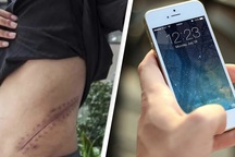 Thiếu niên bán thận mua iPhone 4 năm 2011, giờ ra sao?