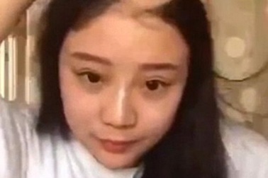 Hậu quả không ngờ của trò đùa dại... ăn ngô bằng máy khoan