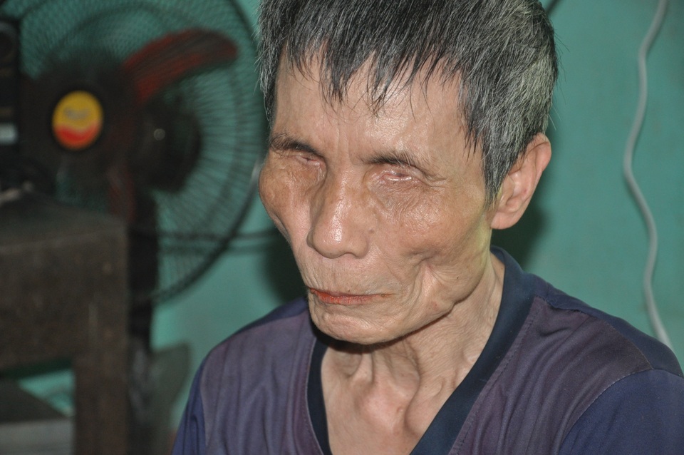 Người đàn ông mù chăm em gái tâm thần xin dừng hỗ trợ - 1 Người đàn ông mù chăm em gái tâm thần xin dừng hỗ trợ - 1
