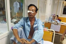 Bị hàng xóm dùng búa đánh thẳng vào mặt vì chuyện "cái cống nước"