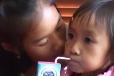 Tìm bệnh cho bé 4 tuổi có khuôn mặt như bà lão