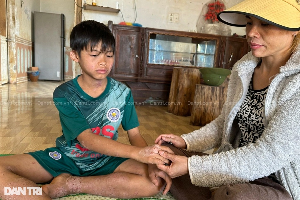 Giá như mẹ có thể chịu thay con những nỗi đau này! - 4 Giá như mẹ có thể chịu thay con những nỗi đau này! - 4