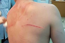 Thuê người truy sát chồng, vợ cũ của bác sĩ Chiêm Quốc Thái bị bắt khẩn cấp