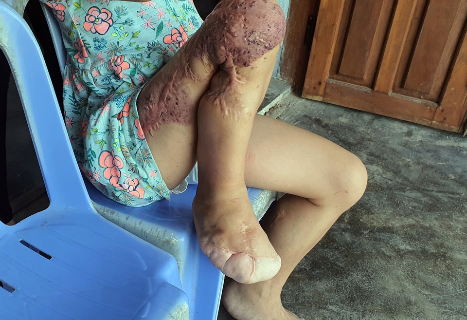 Bạn đọc Dân trí giúp đỡ bé gái hơn 130 triệu đồng tìm sự sống mong manh - 3 Bạn đọc Dân trí giúp đỡ bé gái hơn 130 triệu đồng tìm sự sống mong manh - 3