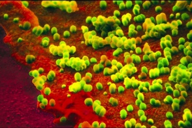 Nhiễm khuẩn: Thủ phạm gây tử vong ở nhiều bệnh nhân cúm A/H1N1